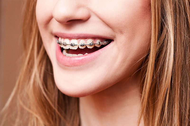 Orthodontics in Oklahoma City